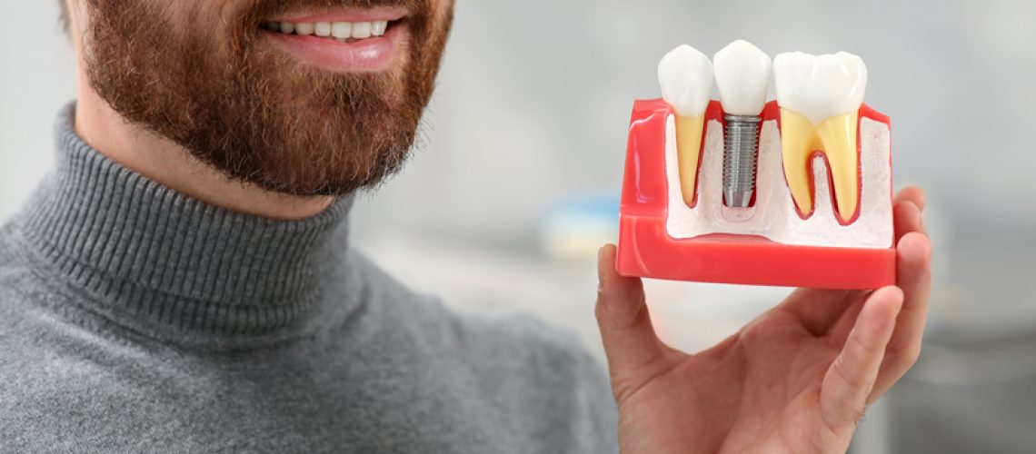 Man holding educational model of dental implant on blurred background, closeup