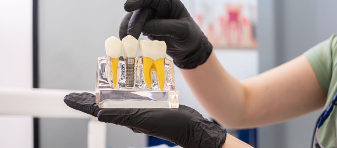 Dental-expert-holding-human-teeth-model-pointing-to-the-crown-of-a-dental-implant-and-offering-advice-on-dental-implant-maintenance-and-healthy-teeth-care