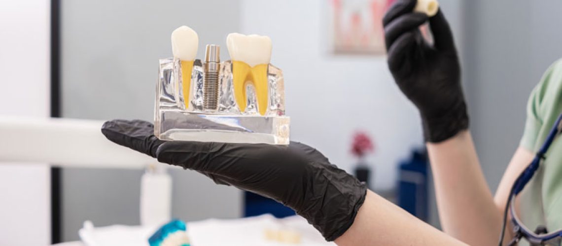 Dentist-hand-with-model-of-human-teeth-highlighting-the-dental-implant-crown