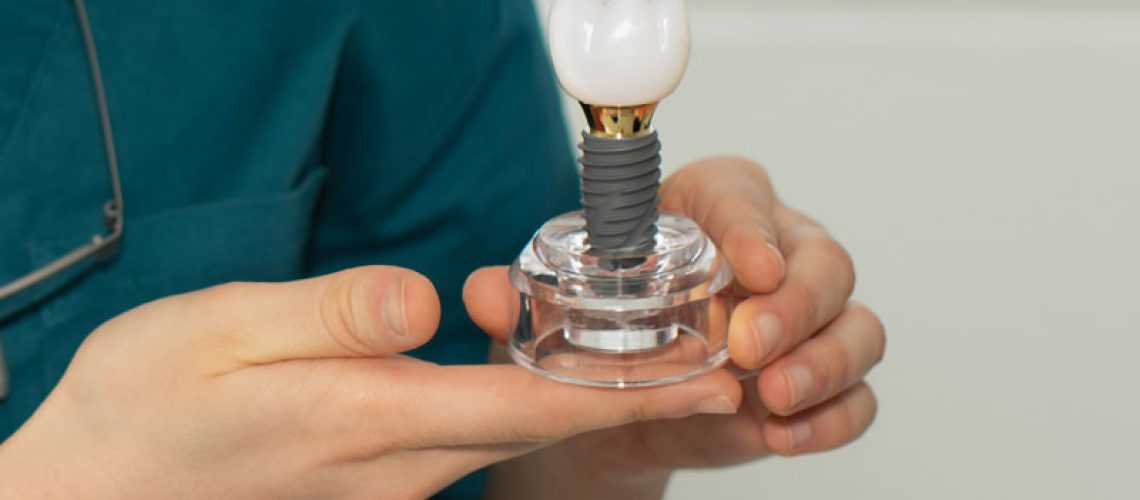 Dentist-holding-a-dental-implant-in-his-hands