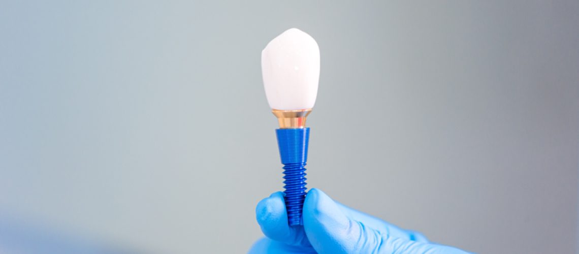 Doctor-holding-dental-titanium-teeth-implant