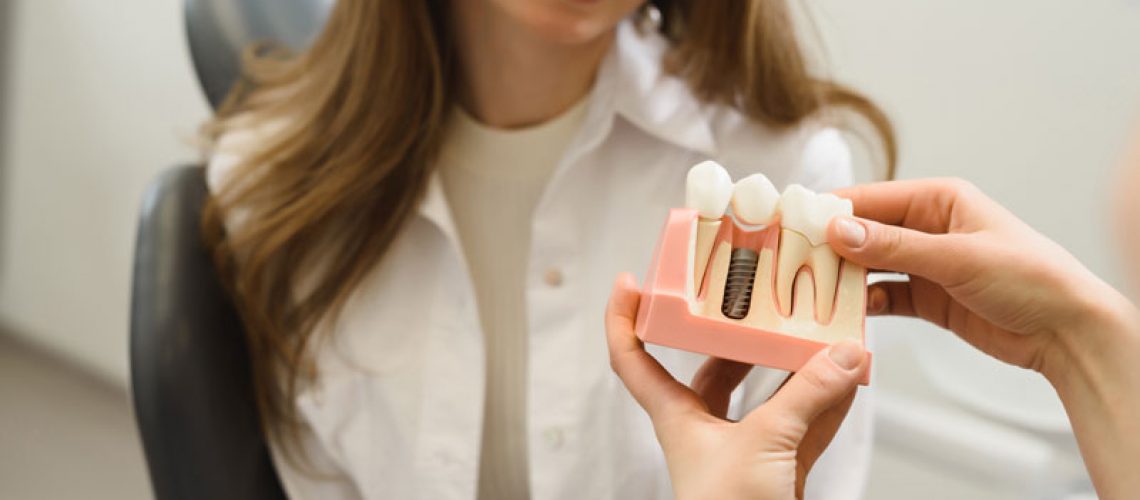 A dentist explains a dental implant model to a patient, showcasing the implant post and crown. The professional setting highlights patient education and advanced dental care.