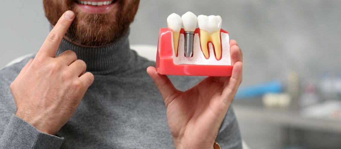 A smiling man with a beard, points to his teeth while holding a dental model showing. The background is blurred, suggesting a dental office setting